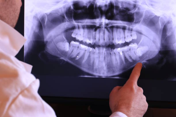 Best Emergency Dental Extractions in Jersey Shore, PA