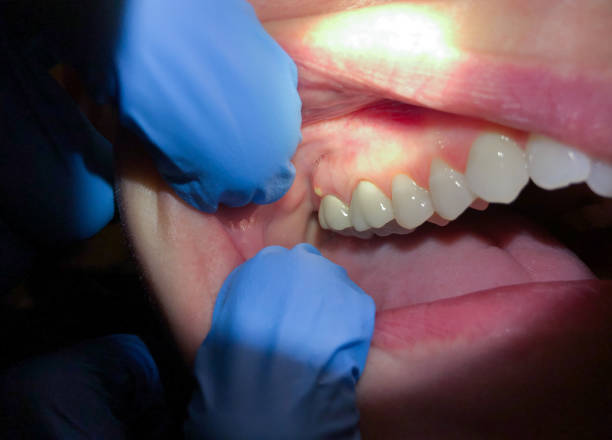 Best Emergency Cosmetic Dentistry in Jersey Shore, PA