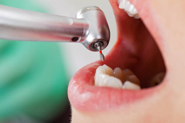 Best Pediatric Emergency Dentist in Jersey Shore, PA